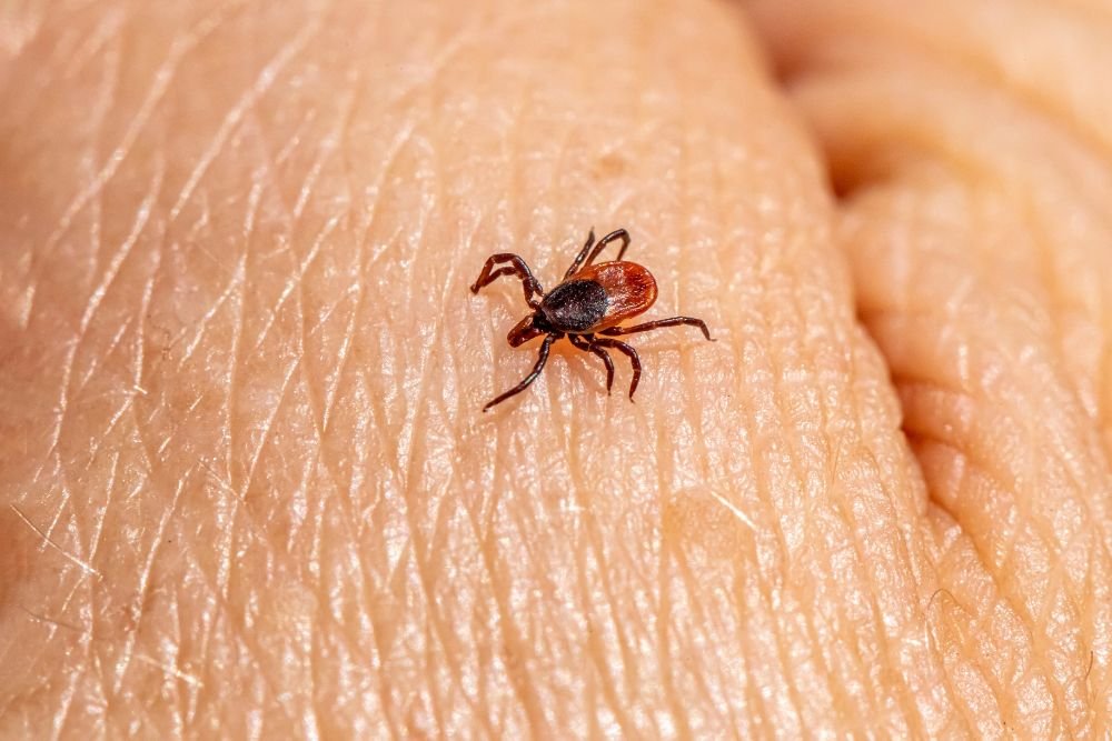 A tick clinging to a person's finger, emphasizing the importance of tick control services in Renton, WA.